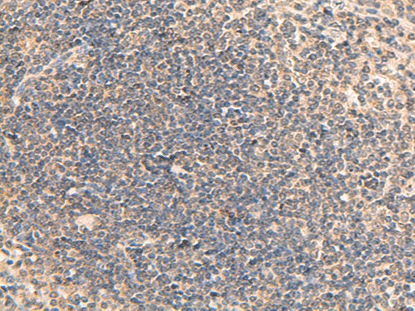 Immunohistochemistry of paraffin-embedded Human tonsil tissue  using RPL13A Polyclonal Antibody at dilution of 1:95(?200)