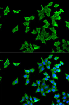 Immunofluorescence analysis of U2OS cells using HTR2B Polyclonal Antibody Blue: DAPI for nuclear staining.