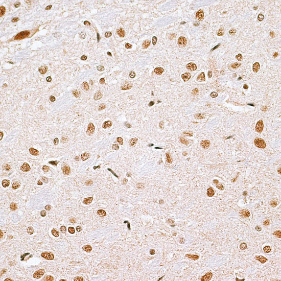 Immunohistochemistry of paraffin-embedded Rat brain using CBX6 Polyclonal Antibody at dilution of  1:100 (40x lens).