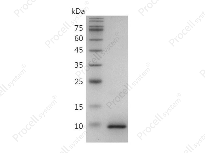 CCL3/MIP-1&alpha;/LD78&alpha;, Human, Recombinant