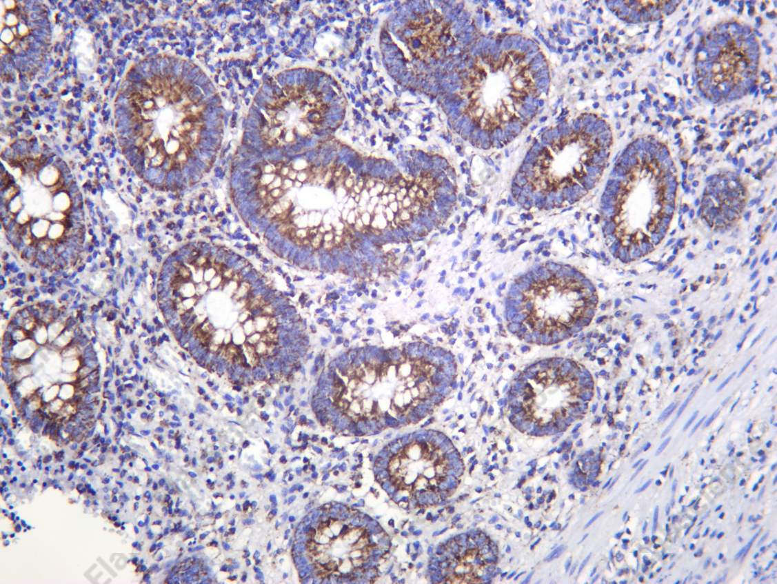 Recombinant SHMT Monoclonal Antibody - 1