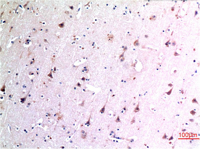 Immunohistochemistry of paraffin-embedded Human brain tissue using BECN1 Monoclonal Antibody at dilution of 1:200.