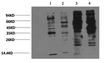 Western Blot analysis of 1) Jurkat, 2) 293T, 3) Rat brain, 4) Mouse brain with Phosphotyrosine Monoclonal Antibody at dilution of 1:2000