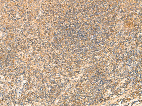 Immunohistochemistry of paraffin-embedded Human tonsil tissue  using PDAP1 Polyclonal Antibody at dilution of 1:50(?200)