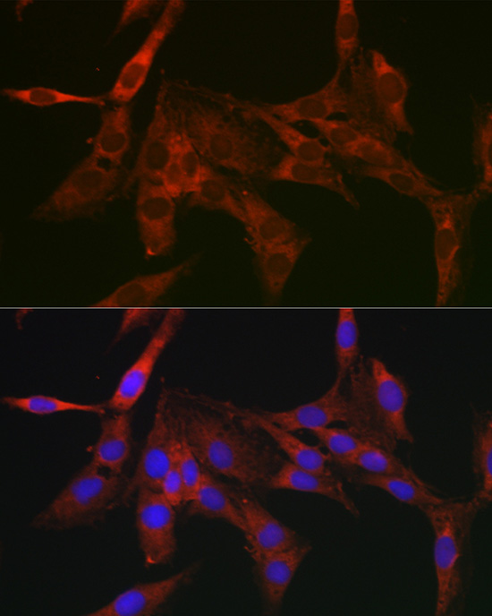 Immunofluorescence analysis of C6 cells using Bcl-2 Polyclonal Antibody at dilution of 1:200. Blue: DAPI for nuclear staining.