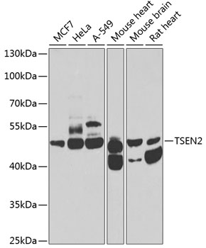 Western blot analysis of extracts of various cell lines using TSEN2 Polyclonal Antibody at 1:1000 dilution.