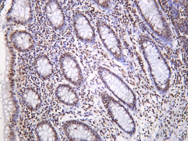 Recombinant hnRNP Q Monoclonal Antibody - 1