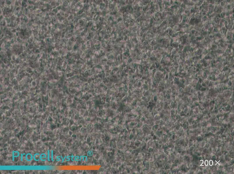 SU-DHL-1 Cell Complete Medium - small - 4