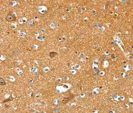 PYGL Polyclonal Antibody - 3
