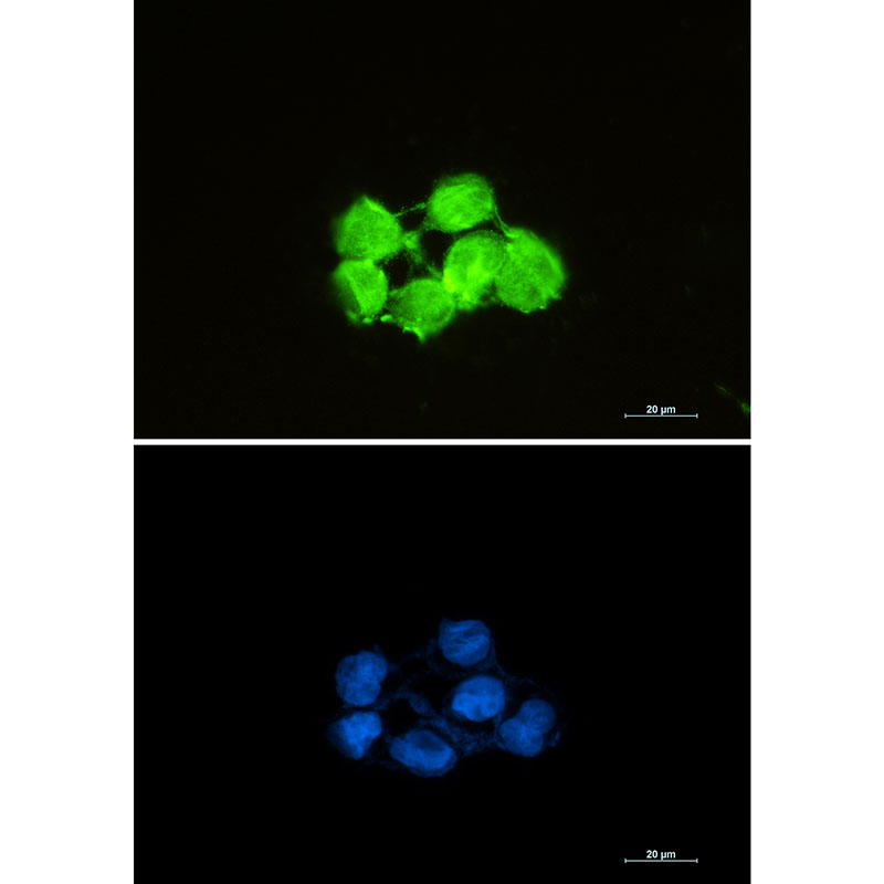 Recombinant SOD1/Superoxide Dismutase Monoclonal Antibody - 3