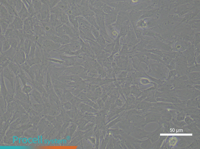 Rat Aortic Adventitial FibroblastsRat Aortic Adventitial Fibroblasts - 6