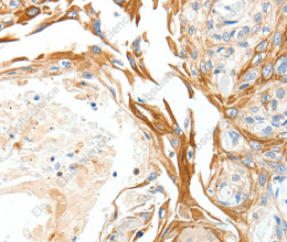 PLAT Polyclonal Antibody - 3