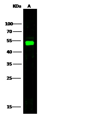 Recombinant E-Selectin/CD62e/SELE Monoclonal Antibody-searchlist-1