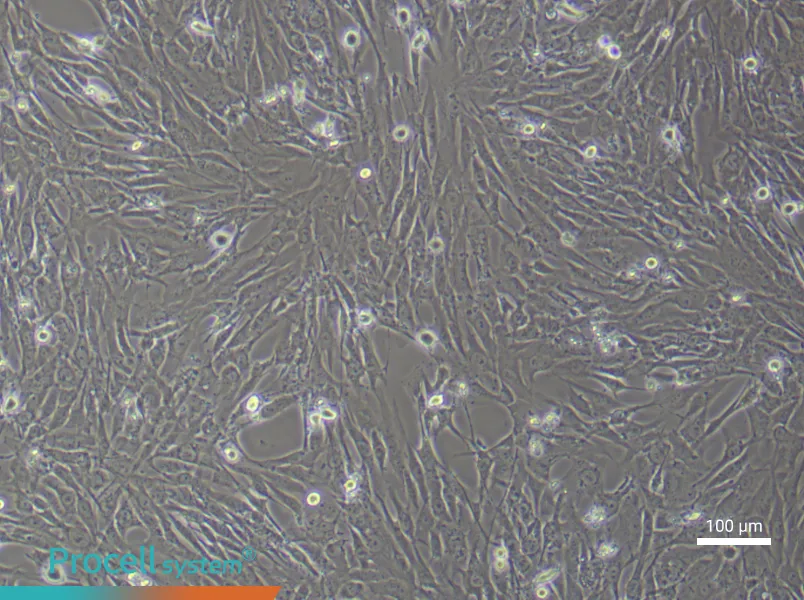 Human Lung Fibroblast (Primary cell immortalization) Complete Medium - 3
