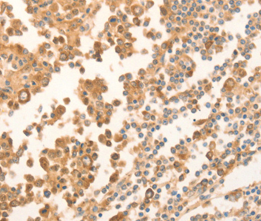 Immunohistochemistry of paraffin-embedded Human tonsil using NAP1L1 Polyclonal Antibody at dilution of 1:70