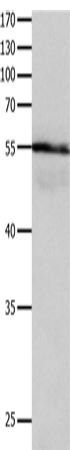 Western Blot analysis of Human brain gliomas tissue using HP Polyclonal Antibody at dilution of 1:400