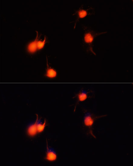 Immunofluorescence analysis of U-251MG cells using BDNF Polyclonal Antibody at dilution of  1:100 (40x lens). Blue: DAPI for nuclear staining.