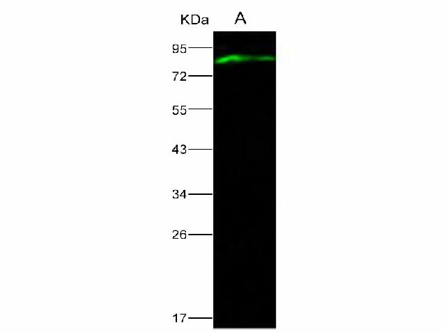 Western Blot analysis of Recombinant EBOV (subtype Sudan, strain Gulu) VP40 / Matrix protein VP40 Protein (His & MBP Tag)(PKSV030147 with 50ng) using Anti-Ebola virus EBOV(subtype Sudan, strain Gulu) VP40/Matrix protein VP40 Polyclonal Antibody at dilution of 1:1000.