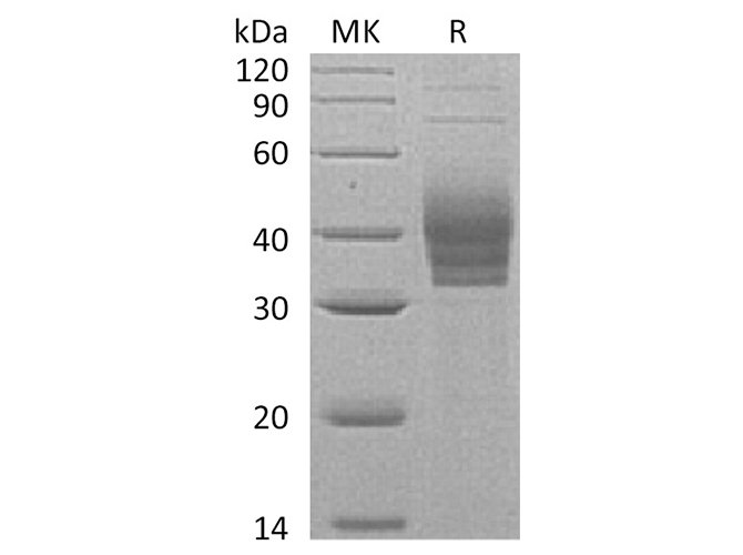 Recombinant Human CLEC4E/Mincel Protein (His Tag)