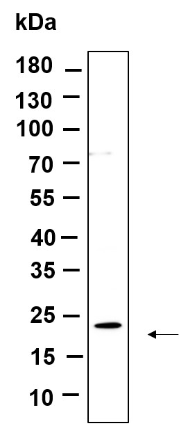 Recombinant Cofilin Monoclonal Antibody-searchlist-1