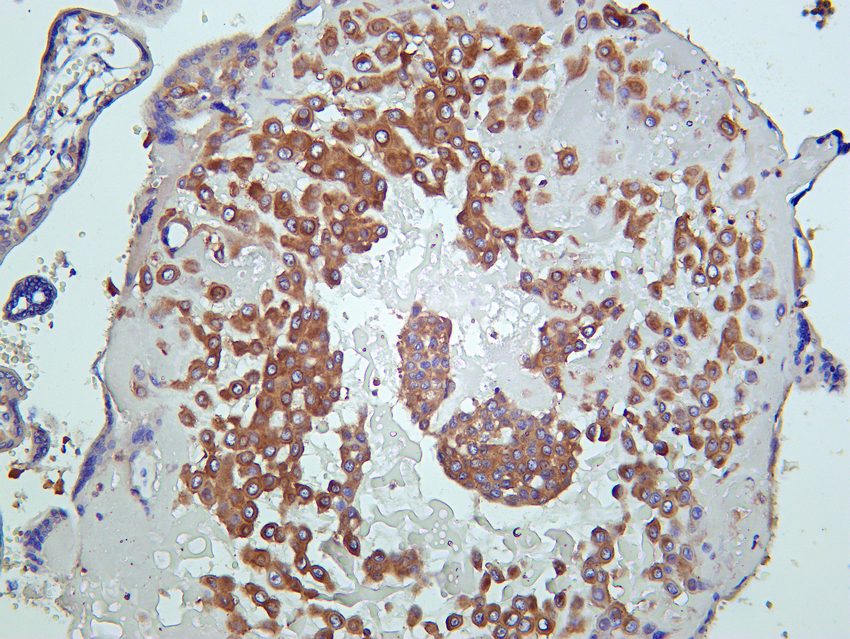 Recombinant PI3-Kinase p85 α Monoclonal Antibody - small - 5