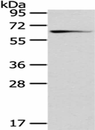 Western Blot analysis of Mouse brain tissue using GAD1 Polyclonal Antibody at dilution of 1/200