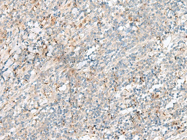 Immunohistochemistry of paraffin-embedded Human tonsil tissue  using PLCL2 Polyclonal Antibody at dilution of 1:50(?200)