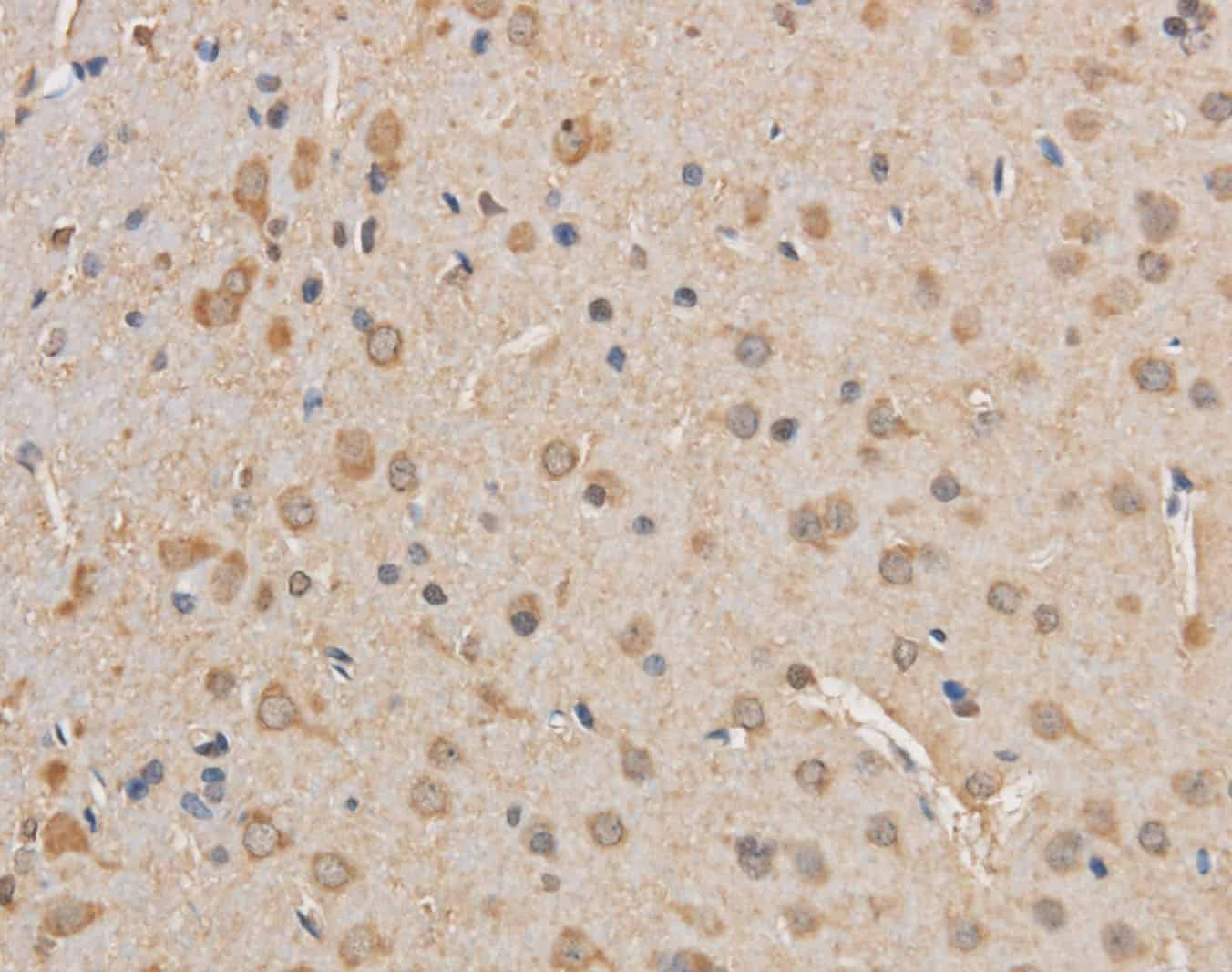 Immunohistochemistry of paraffin-embedded Rat brain using VDAC1 Polyclonal Antibody at dilution of 1:50