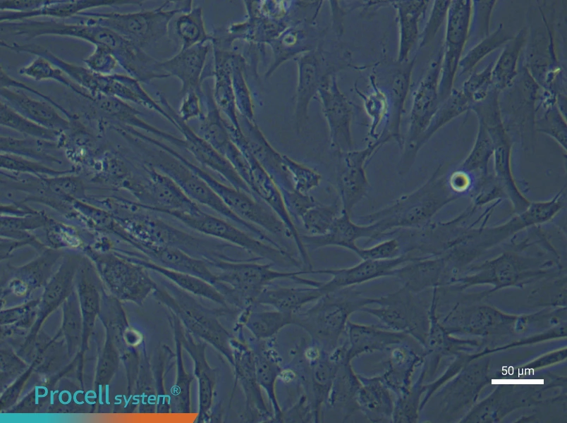 Human Pulmonary Artery Smooth Muscle (Primary cell immortalization) Cell Complete MediumHuman Pulmonary Artery Smooth Muscle (Primary cell immortalization) Cell Complete Medium - 5