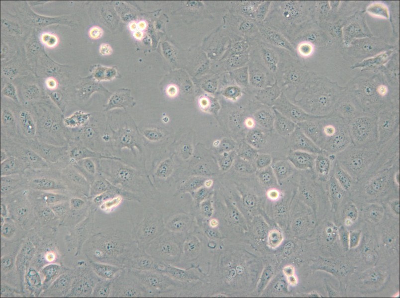 SVEC4-10 Cell Complete Medium - 6