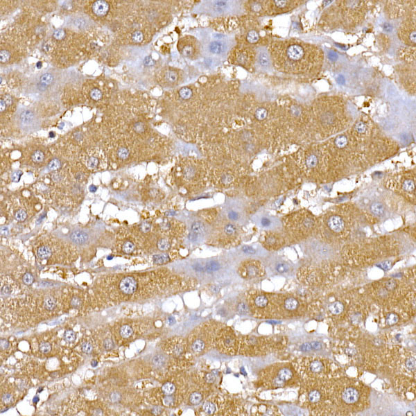 PGC1 alpha Polyclonal Antibody - small - 7