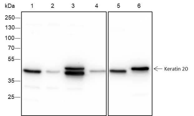 Recombinant Keratin 20 Monoclonal Antibody-searchlist-1