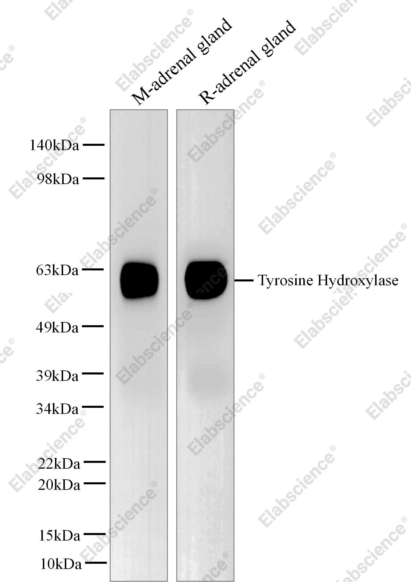 Recombinant TH/Tyrosine Hydroxylase Monoclonal Antibody - 1