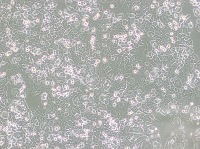 NCI-H2126 Cell Complete Medium-searchlist-1