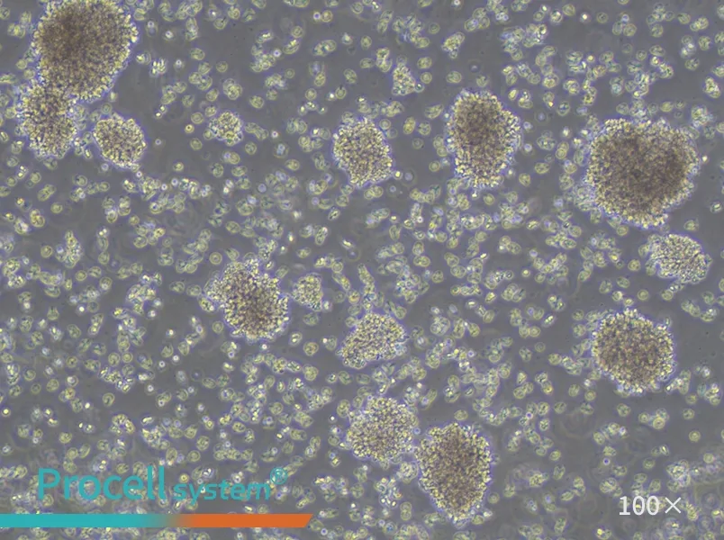 YAC-1 Cell Complete Medium - 1