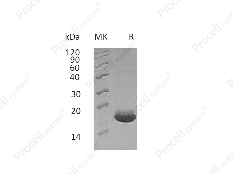 MANF/ARMET/ARP (C-6His), Human, Recombinant
