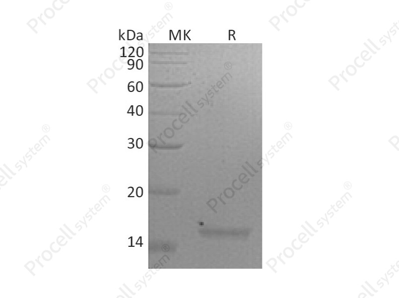 IL-21/Za11, Mouse, Recombinant