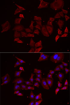 Immunofluorescence analysis of MCF7 cells using NPHP1 Polyclonal Antibody