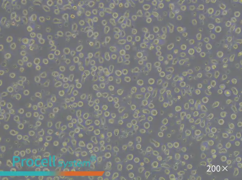 JeKo-1 Cell Complete Medium - 6