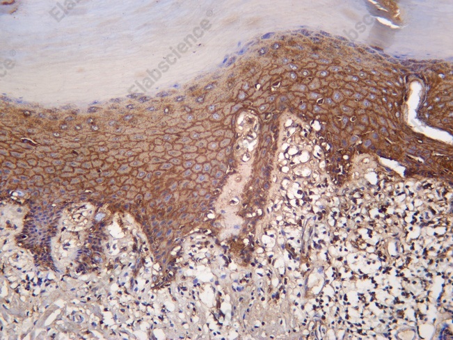 Recombinant Involucrin Monoclonal Antibody - 1