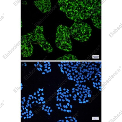 Recombinant cAMP Protein Kinase Catalytic subunit Monoclonal Antibody - 3
