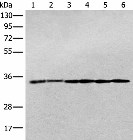 Western blot analysis of Jurkat cell Human breast cancer tissue Hela cell Human fetal brain tissue Human cerebrum tissue Rat brain tissue lysates  using PITPNB Polyclonal Antibody at dilution of 1:400