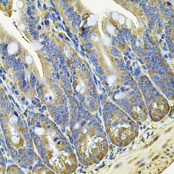 Immunohistochemistry of paraffin-embedded Mouse intestine using EIF3C Polyclonal Antibody at dilution of  1:100 (40x lens).