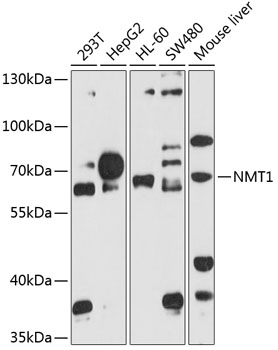 Western blot analysis of extracts of various cell lines using NMT1 Polyclonal Antibody at 1:1000 dilution.