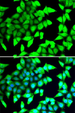 Immunofluorescence analysis of A549 cells using HDAC5 Polyclonal Antibody