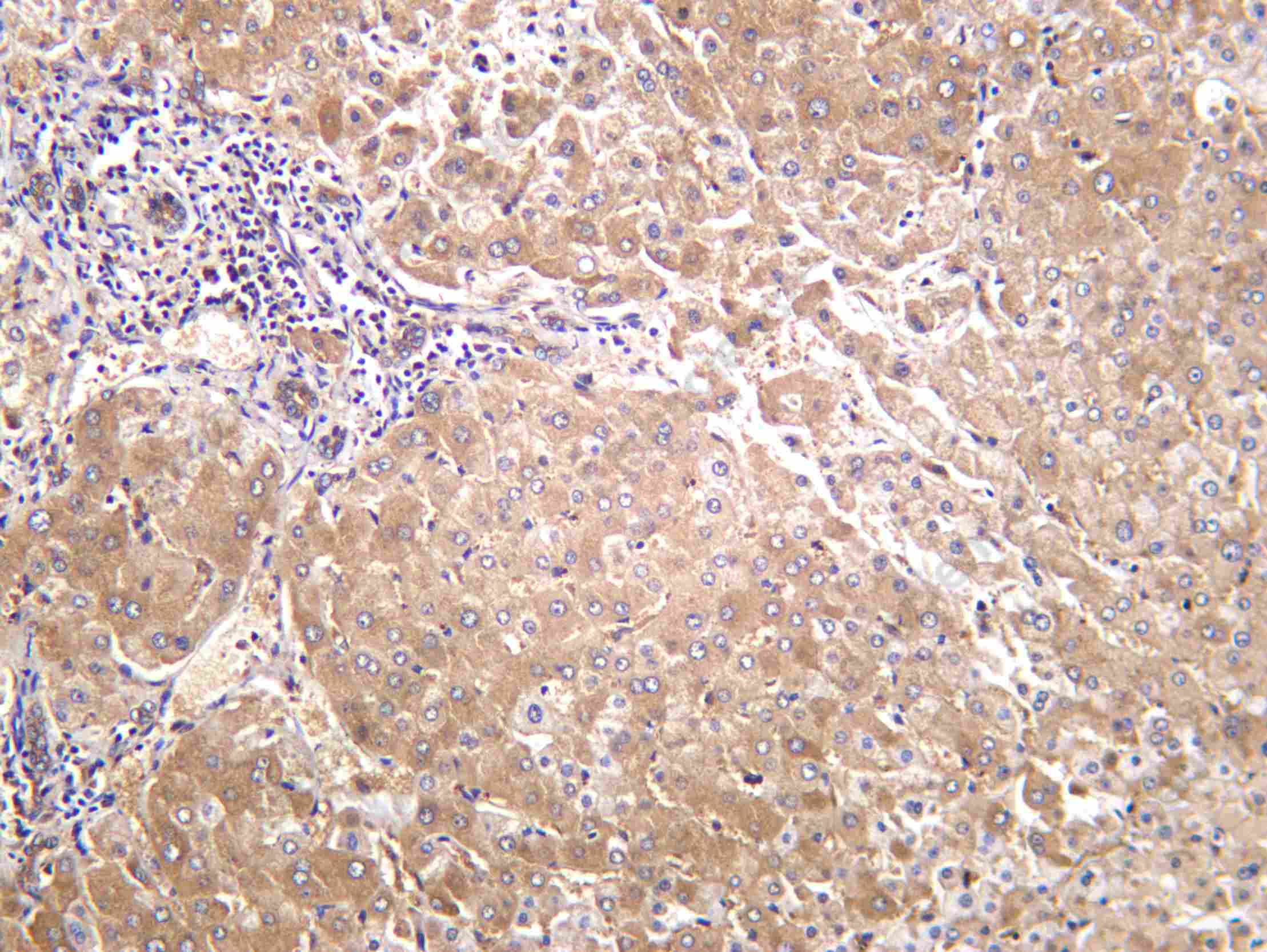 Recombinant alpha 1a Adrenergic Receptor Monoclonal Antibody - 2