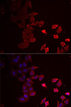 Immunofluorescence analysis of MCF7 cells using P2RX4 Polyclonal Antibody