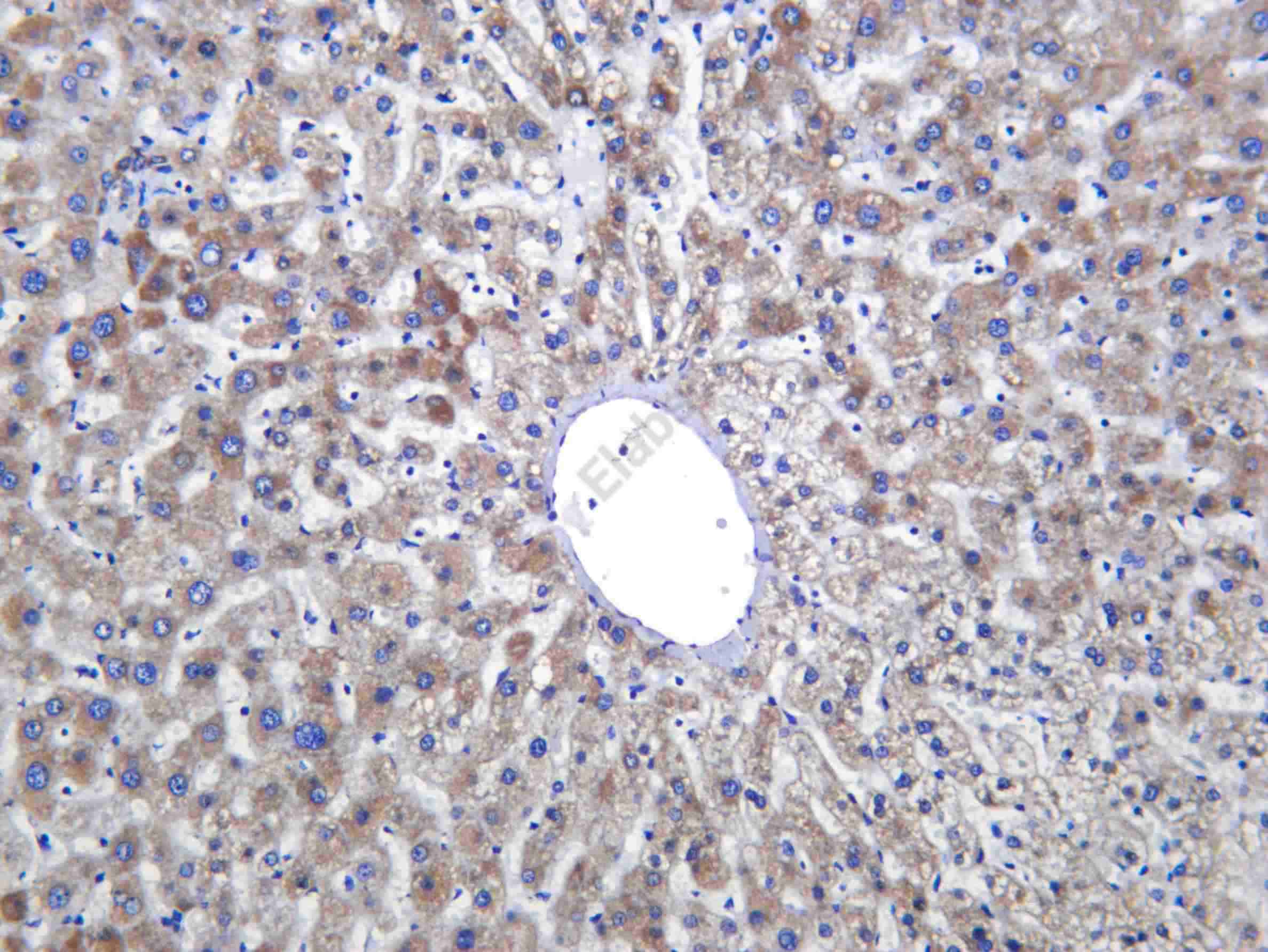 Recombinant MAOB Monoclonal Antibody - 2