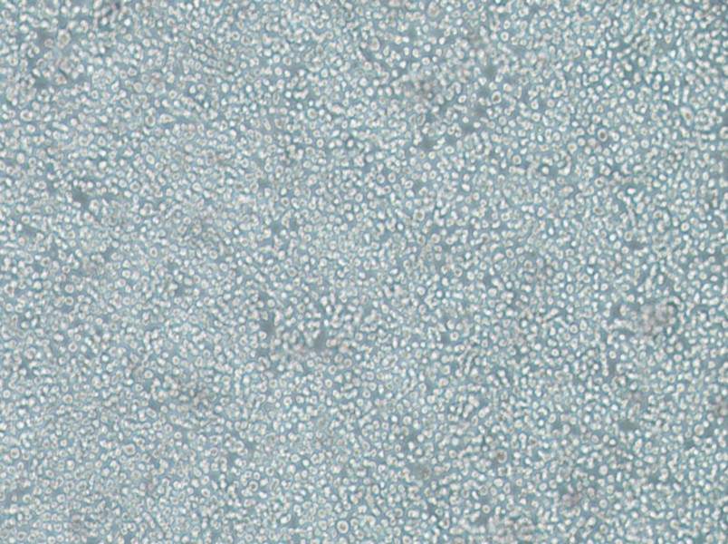 SKNO-1 Cell Complete Medium-searchlist-1