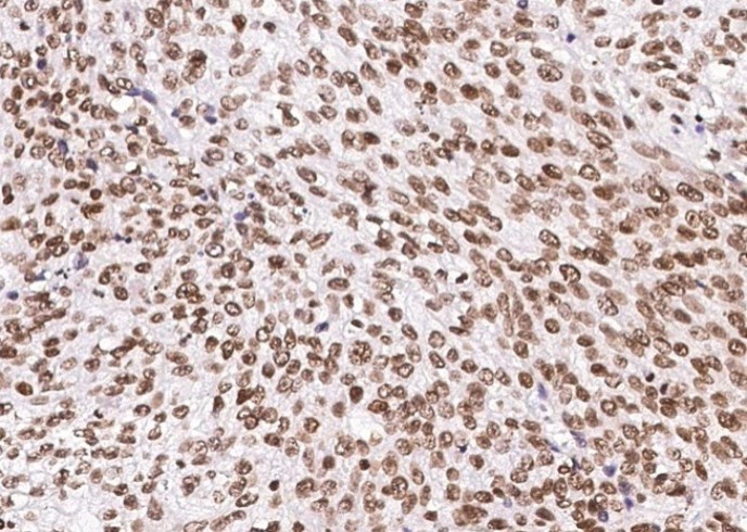 SIRT1 Monoclonal Antibody - small - 2